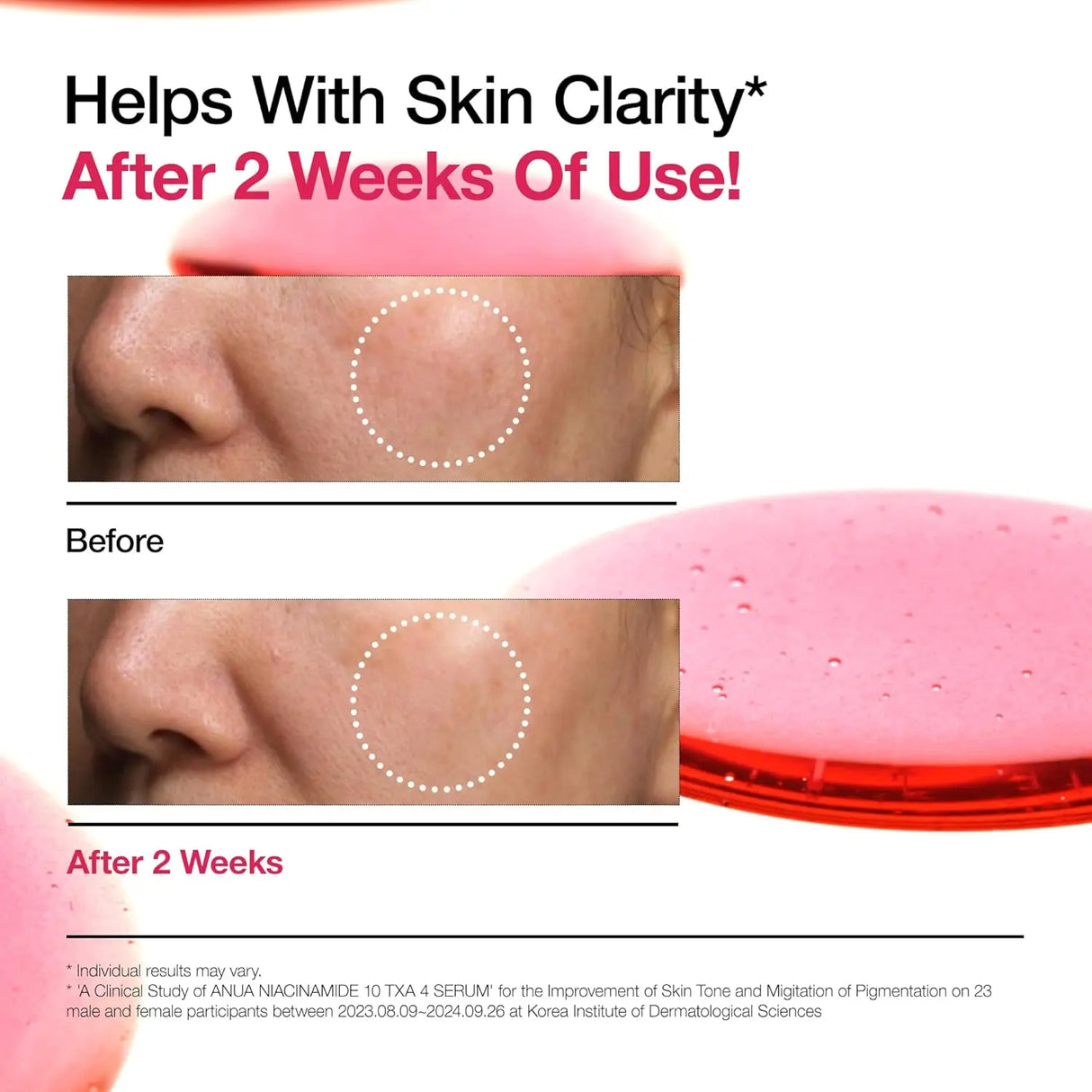 ANUA Niacinamide 10% + TXA 4% Serum 30ml - Glagil